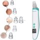 Beper Rechargeable Pore and Blackhead Vacuum Removes Blackheads, Sebum, Impurities, and Acne from Clogged Pores