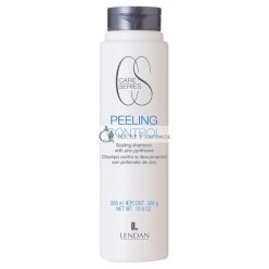 3D Mask Bracket Peeling Control